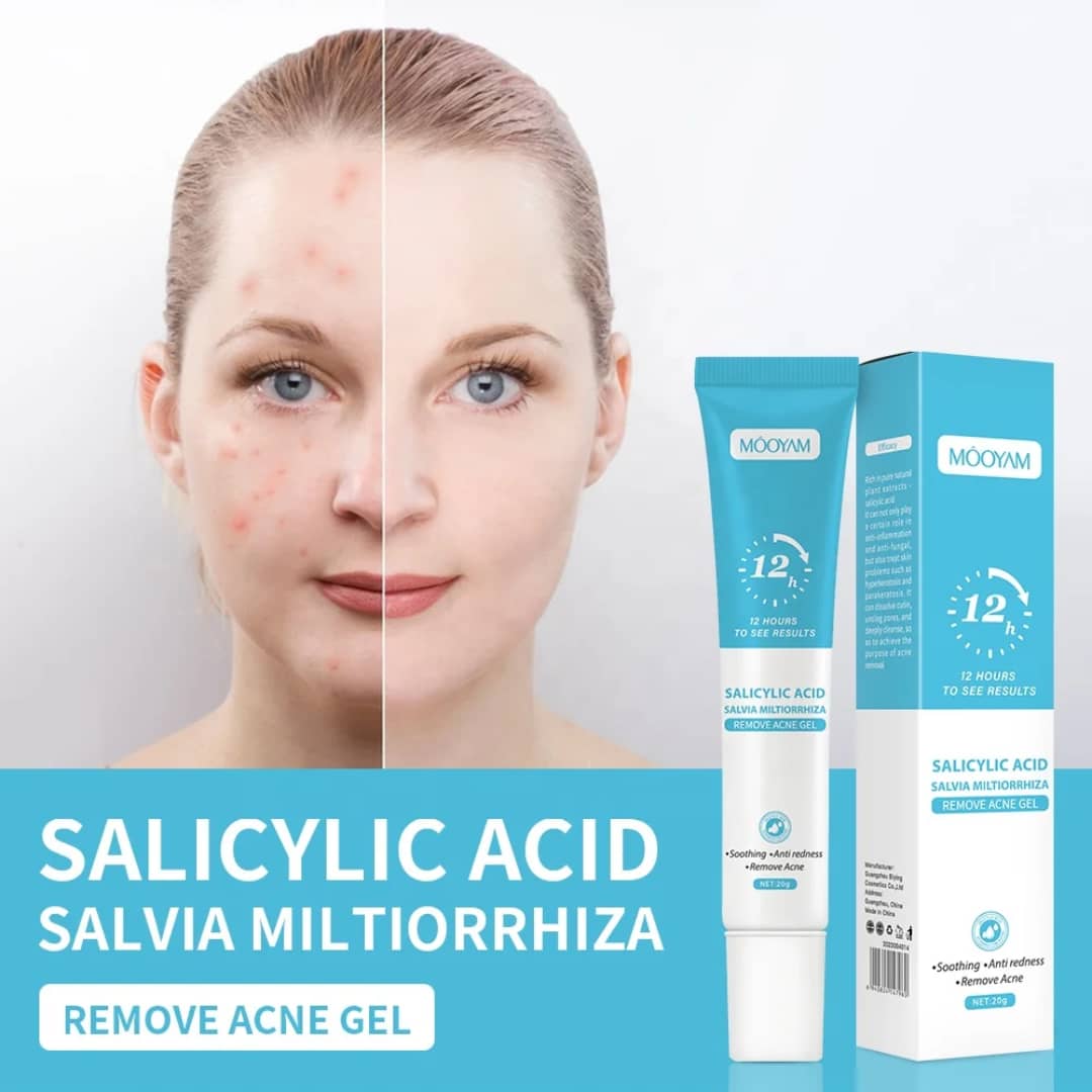 Gel Anti-Acné MÔOYAM à l'Acide Salicylique