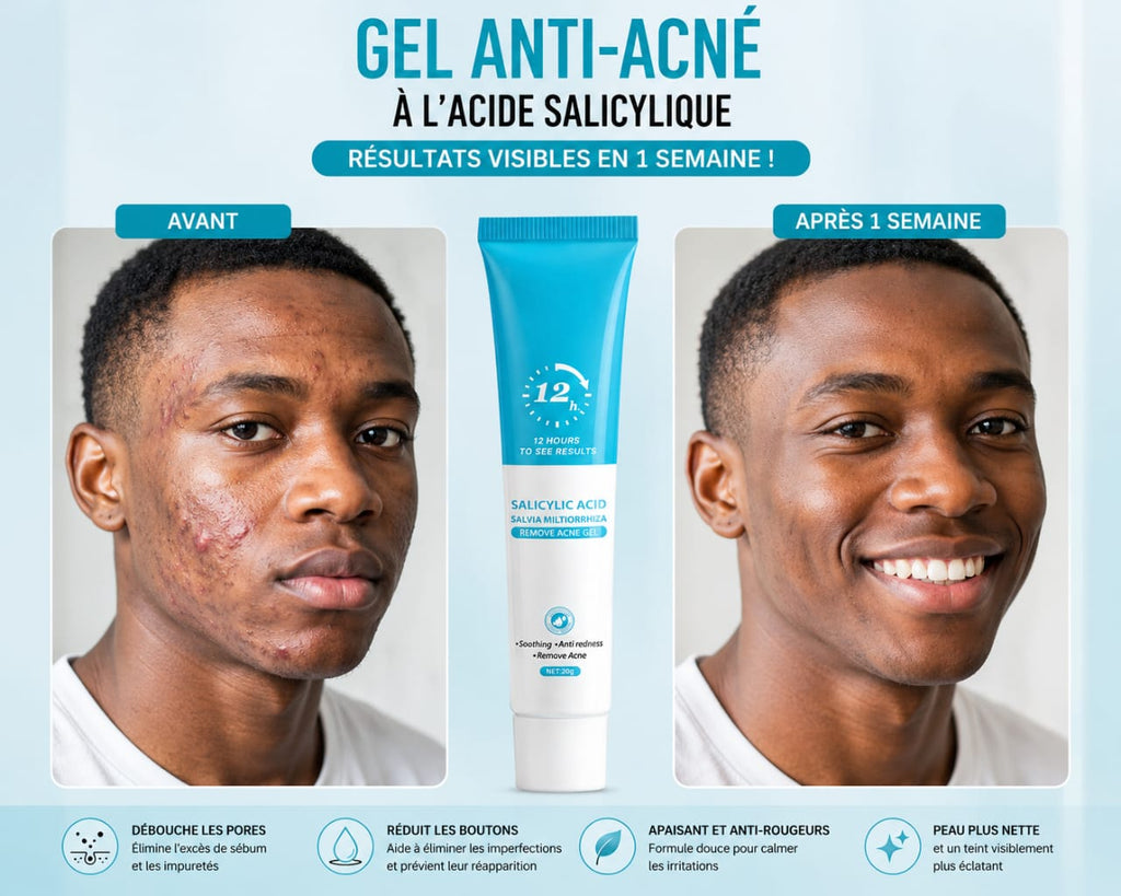 Gel Anti-Acné MÔOYAM à l'Acide Salicylique